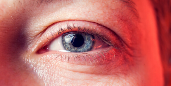 Illustration of tear duct obstruction, representing dacryology treatment options