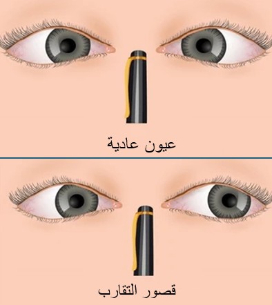CI arabic