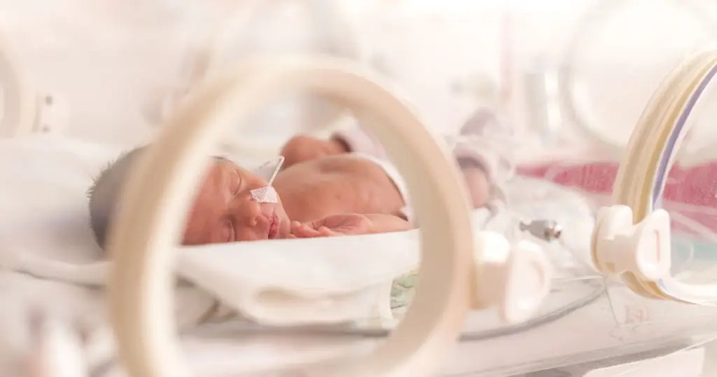 Premature baby lying in an incubator with a nasal tube for breathing support, illustrating baby under care for retinpathy of prematurity