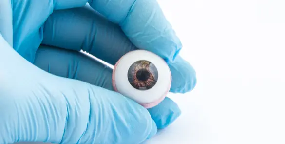 Custom artificial eye prosthesis held by an Ocularist at Moorfields Eye Hospital Dubai